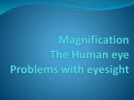 correcting human eye defects ppt File