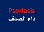 Psoriasis - Dermatology Oasis