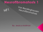 Neurofibromatosis 1 - shsbiogeneticdisorders