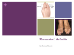 Rheumatoid Arthritis