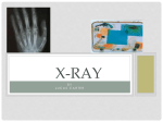 X-RAY - lucascarter