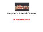 What is Peripheral Arterial Disease? Peripheral arterial disease