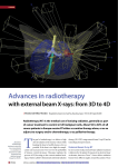 Advances in radiotherapy with external beam X