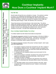 Cochlear Implants: How Does a Cochlear Implant Work?