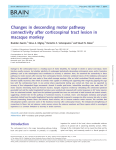Changes in descending motor pathway connectivity after