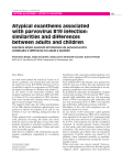 Atypical exanthems associated with parvovirus B19 infection