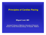 Principles of Cardiac Pacing