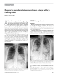 Wegener`s granulomatosis presenting as a large