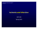 Ischemia and Infarction