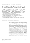 Line-profile tomography of exoplanet transits – II. A gas