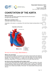 coarctation of the aorta