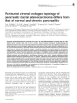 Periductal stromal collagen topology of pancreatic ductal