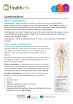 Lymphoedema - HealthInfo