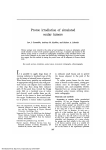 Proton irradiation of simulated ocular tumors.