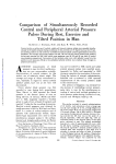 Comparison of Simultaneously Recorded Central and Peripheral