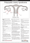 Polycystic ovary syndrome