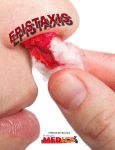 Surgical treatment of severe epistaxis: an