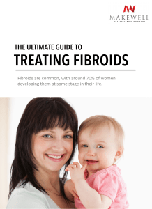 the ultimate guide to treating fibroids