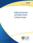 Radical Cystectomy and Indiana Pouch: A Patient`s Guide