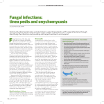 Fungal infections: tinea pedis and onychomycosis