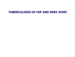 tuberculosis of hip and knee joint