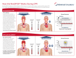 How the ResQPOD® Works During CPR
