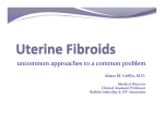 Uterine Fibroids: Uncommon Approaches to a Common Problem