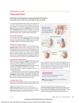 Testicular Mass