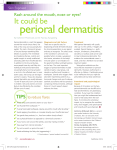 perioral dermatitis - Canadian Skin Patient Alliance