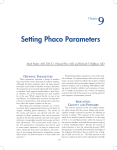 Setting Phaco Parameters