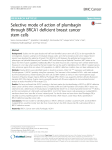 Selective mode of action of plumbagin through BRCA1 deficient