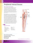 Peripheral Arterial Disease