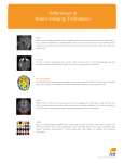 Comparisons of Neuro-Imaging Technologies