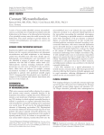 Coronary microembolization