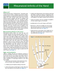 Rheumatoid Arthritis of the Hand