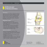 Knee Arthroscopy - The Belfast Knee Clinic