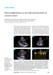 Heart palpitations as an early presentation of a heart tumor
