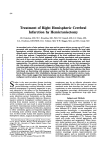 Treatment of Right Hemispheric Cerebral Infarction by