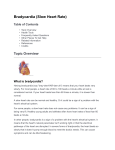 Bradycardia (Slow Heart Rate)