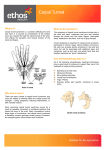 Carpal Tunnel - Ethos Health