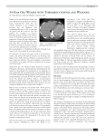 34 year old woman with thrombocytopenia and weakness