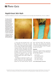 Rapid-Onset Skin Rash