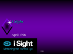 i Sight