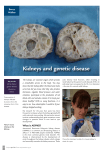 Kidneys and genetic disease