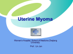 Uterine Myoma