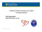 Artificial Heart Pumps and Heart Transplantation