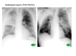 interstitial pneumonia triangle dittmar rupert