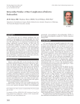 Intracardiac Fistulae: A Rare Complication of Infective