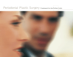 Periodontal Plastic Surgery Framework for the Perfect Smile