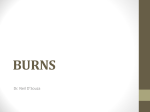 burns - Yengage